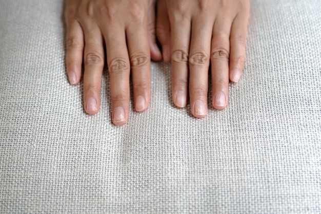 Белые точки под ногтями рук: причины и диагностика