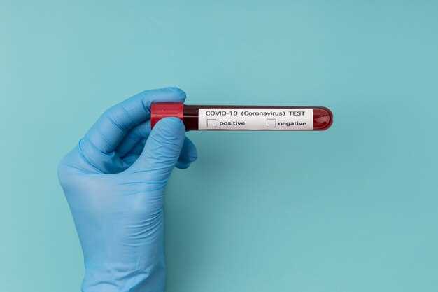 Как правильно подготовиться к экспресс тесту на ВИЧ?