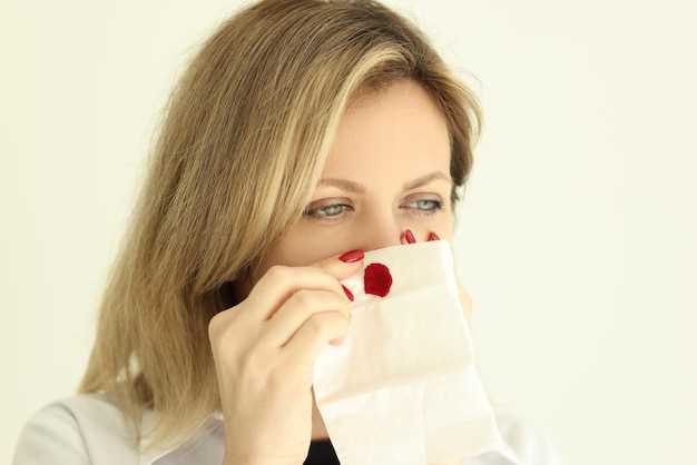 Причины крови из носу у взрослого