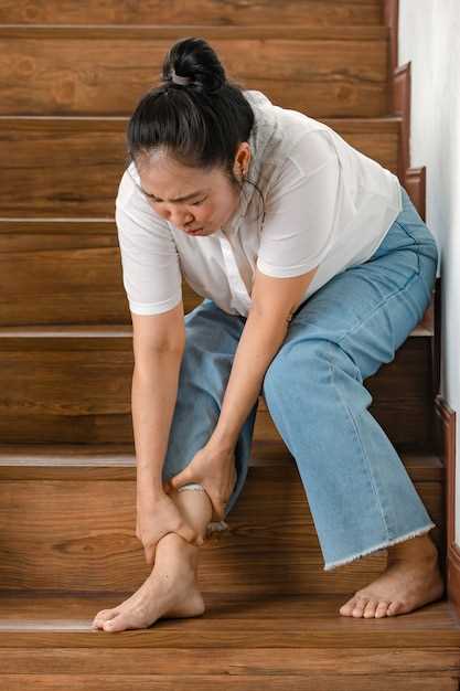 Вредное воздействие варикозных вен на ноги у женщин