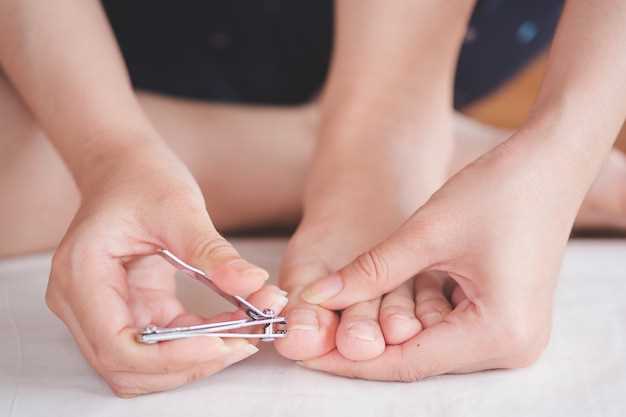 Что влияет на утолщение ногтей: