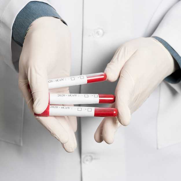 Что такое общий анализ крови?