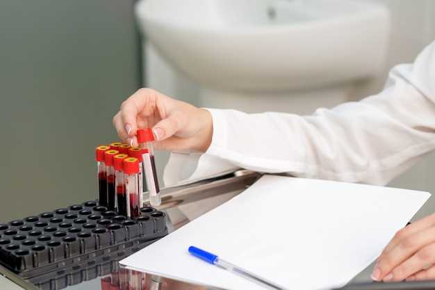 Как определить анемию по анализу крови?
