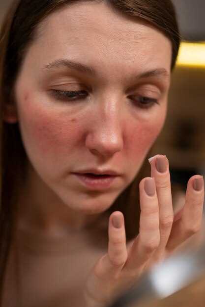 Эффективные методы лечения грибка на лице