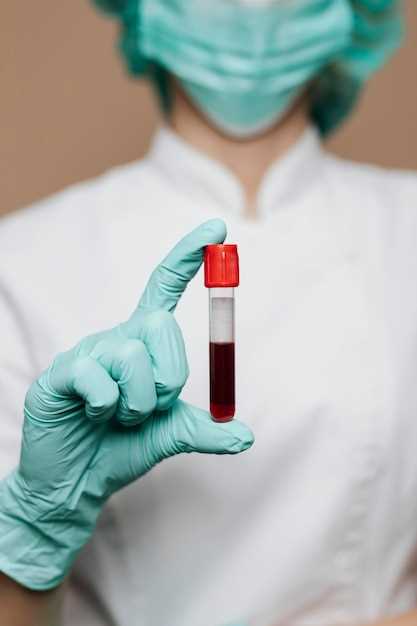 Получение крови на гемоглобин: процесс у взрослых