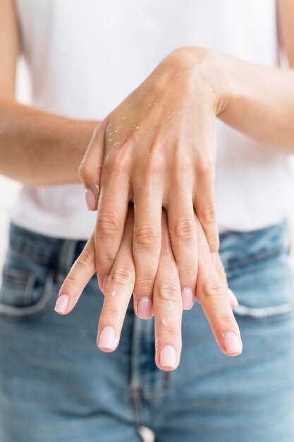 Связь между отсутствием лунок на ногтях и дефицитом железа