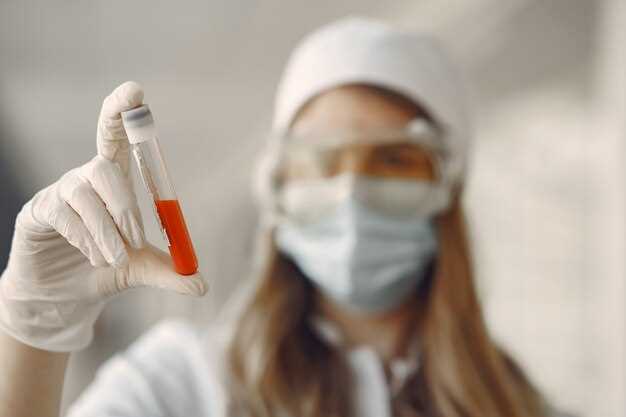 Повышенный общий билирубин в крови женщин